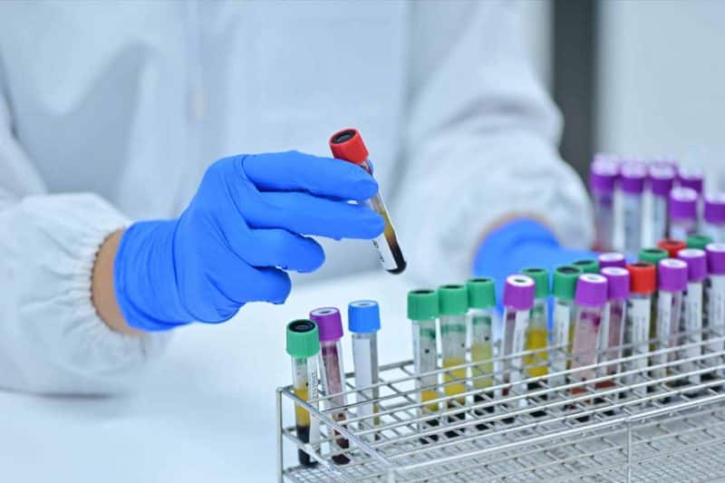 An assay of blood samples used in alpha 2 macroglobulin therapy testing.